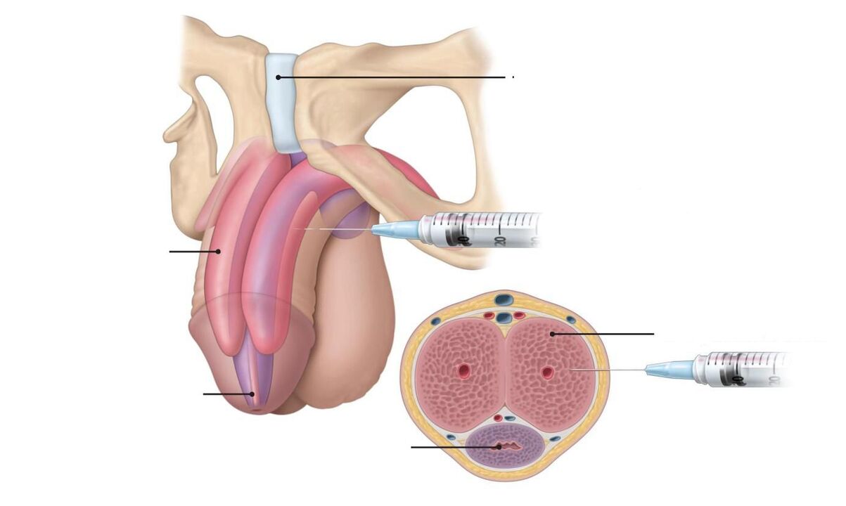 injection for increased potency